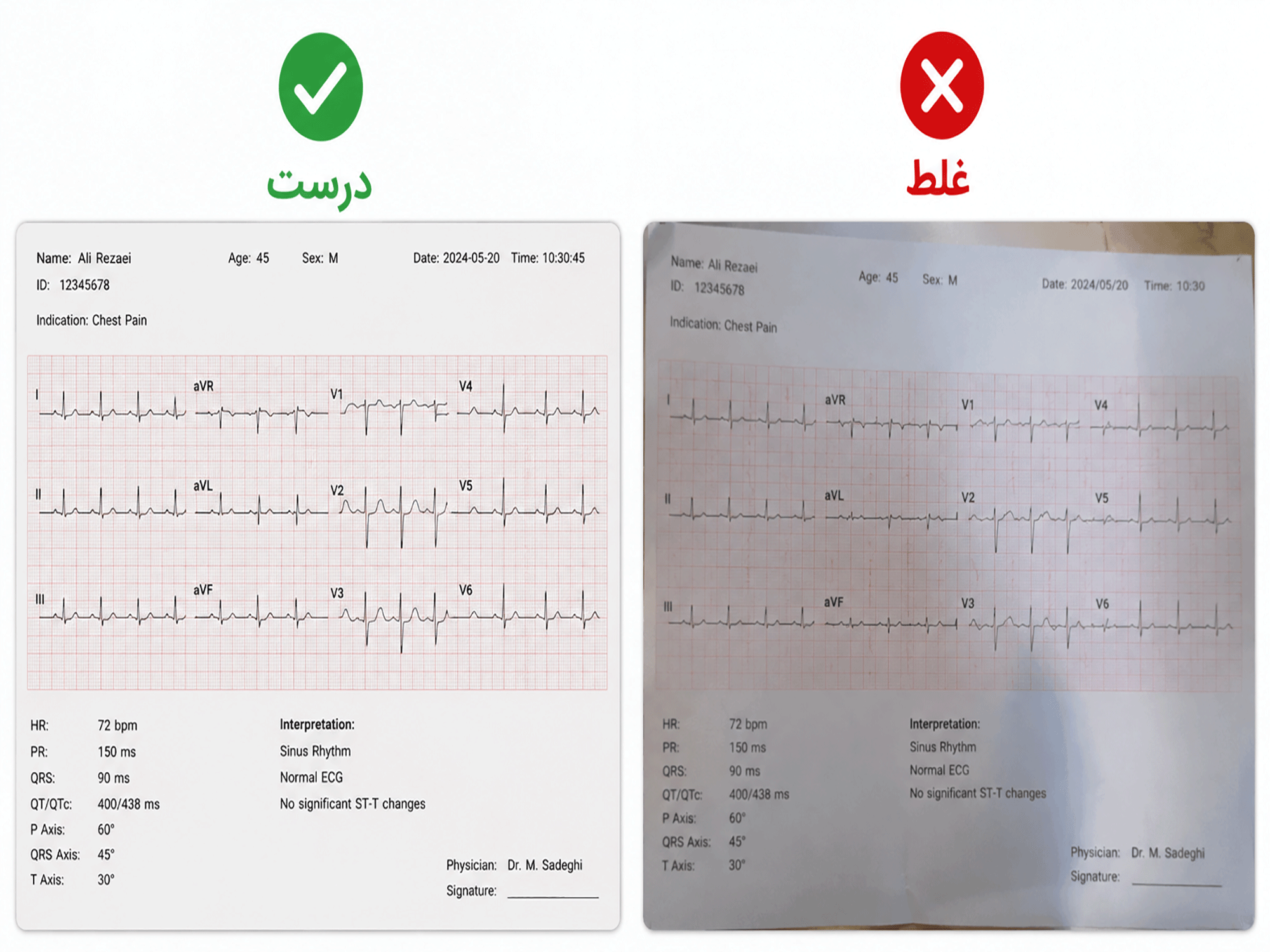 نمونه گزارش نوار قلب